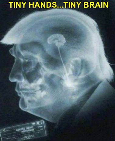Tiny-Hands-Tiny-Brain_mini_tiny.jpg
